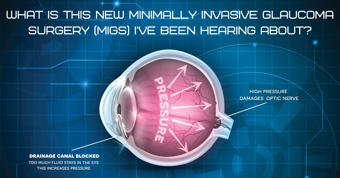  What Is Minimally Invasive Glaucoma Surgery 