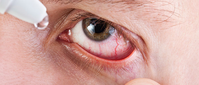 safe use redness relief eye drops